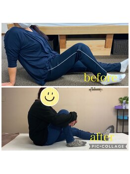 アルマ(ALMA)/股関節の不調：40代女性