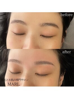 マール(MARL.)/ハリウッドブロウリフト