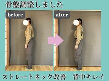 シェノン(Chainon)/骨盤調整　肩甲骨はがし