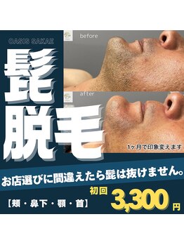 オアシスサカエ(OASIS SAKAE)/【都度払いエステ 髭脱毛】