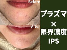 ポンディシェリ(Pondicherry)の雰囲気（やればわかるこの凄さ。肌の治安をみるみる上げていく）