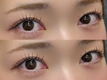 エヌアイズ(neYES!)/&healthy ブラウン100本