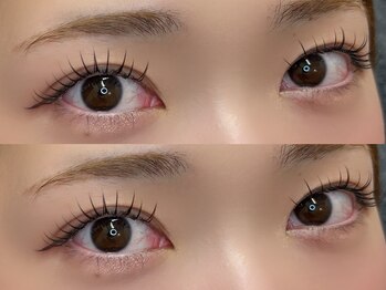 エヌアイズ(neYES!)/&healthy ブラウン100本