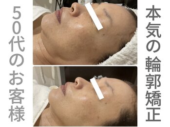 ピュウリリアーナ(Piu liliana)/