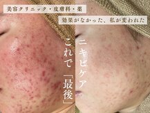 ウルワシ(Uruwashi)