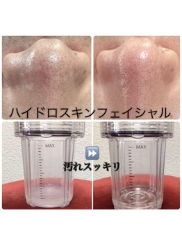 プリマプリート メンズ店の写真/男性の清潔感は肌で決まる！男性特有の毛穴汚れ吸引、ざらざら肌も美肌に◎理想の肌へ★