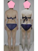 アルマ 芦屋(ALMA)/体重1.8ｋｇ減うち脂肪1.7ｋｇ！