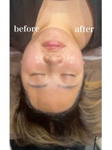 小顔 ツヤ肌/お顔は変わります