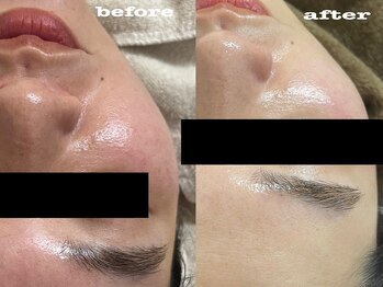 ローラン(LORAN)/フェイシャルワックス