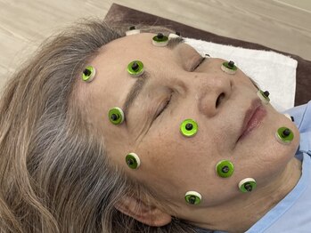 はりきゅう漫々の写真/【肌のハリツヤUP、引き締め効果◎】肌の“土台”にアプローチする美容鍼・美容灸で、肌の内側から美しく。