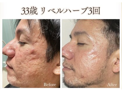 リラ 都城店(Lilas)の写真