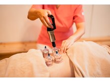 たから鍼灸院/カッピング