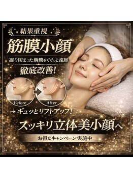 シャルム ド ケー(charme de k)の写真/【筋膜小顔スペシャル¥9900】老廃物の排出を促進!深層筋膜にアプローチ☆施術後のスッキリ感に感動♪