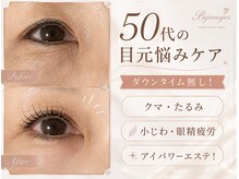 ビジューアイズ(Bijou eyes)