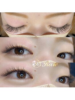 レビー(Revie)/バインドロック