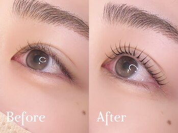 ミラ(Mila)/Before ⇒ After