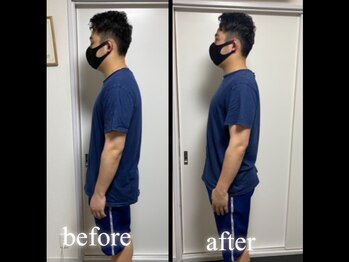 サンクエール 代官山鍼灸院(CINQ AILES)/姿勢矯正　猫背・巻き肩