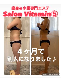サロン ビタミンファイブ(Salon Vitamin5)/上半身薄くなります♪( ´▽｀)