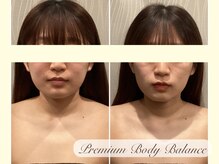 プレミアムボディバランス 上尾(Premium Body Balance)/施術結果