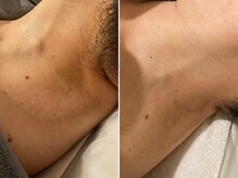 プライベートエステティックサロン クール(Coeur)/お家ケア【ネッククリーム】