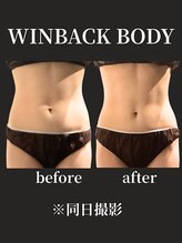 ノーブルノアール(Noble noir)/新機能で、楽して腹筋ケア☆