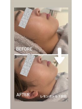 カエラ(KAELA)/レモンボトル初回