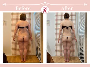 サロン アール(Salon R)/痩身施術×食事・インナーケア