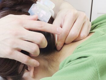 経堂鍼灸整体院の写真/美容鍼、小顔矯正、首肩コリ、慢性的な身体のお悩みに◎一人一人に合った施術で、身体の不調を改善!