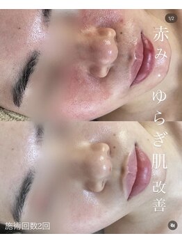 ウェリスト まこトレ整体院(WELIST)/before after