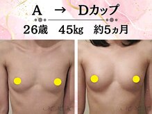 メディカルサロン エム エム エム 大阪梅田グランドサロン(M.M.M)の雰囲気（ボリュームUP技術が豊富！寄せ集めるのではなく内側からバストUP）