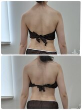 レスプロンディール(Resplendir)/背中の脂肪もスッキリ☆