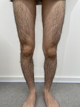 ロイビー(loeyB)/毛深い足