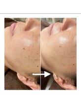 ソイ(Soi)/気になる色味が薄くなる快感！