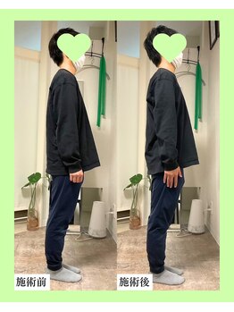 ミライビ(MIRAIBI)/カイロ整体+骨盤矯正３