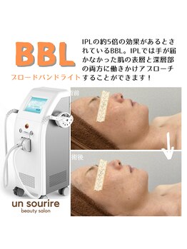 アンスリール(un sourire)/BBL光フェイシャル