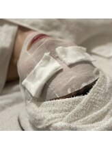 ポーラ ザ ビューティ 鳥取北店(POLA THE BEAUTY)/シワケアオプション