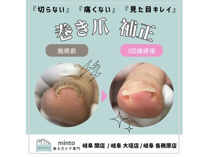 ミント 岐阜関店(minto)の写真