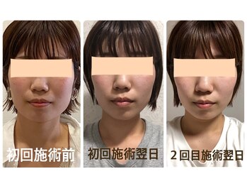 クリーム 京都店(Cream)/