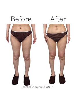 プランツ(PLANTS)/40代／４回／下半身太り