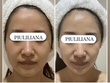 ピュウリリアーナ(Piu liliana)/