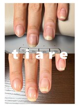 ティアレ(tiare)/１ヶ月の変化
