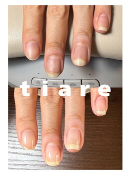 ティアレ(tiare)/１ヶ月の変化