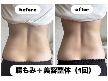 イロハ(1680 IROHA)の写真/寝ているだけで理想のくびれへ！脂肪分解×腸もみで叶えるスピードサイズダウン！