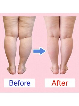バランスアップラボ(バランスアップLAB)の写真/重だるい、靴下の痕がつくくらいパンパンの足…