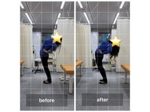 ナオル整体 飯田橋院(NAORU整体)/Before After/飯田橋/整体・矯正