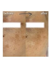 グランクレール トウキョウ(GRANDCLAIRE.TOKYO)/陶肌トリートメント