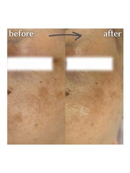 グランクレール トウキョウ(GRANDCLAIRE.TOKYO)/陶肌トリートメント