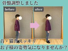 シェノン(Chainon)/お子様にも