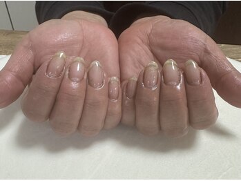 爪の痛み、亀裂改善