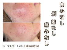 ミー(美mee)